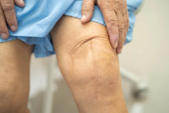 Post-Op Care After Knee Replacement: What to Do the First 6 Weeks
